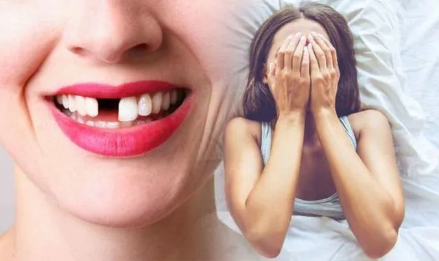 Phụ nữ mơ thấy mình bị rụng răng hàm trên, điều đó cho thấy rằng bạn có thể sẽ được gả vào hào môn